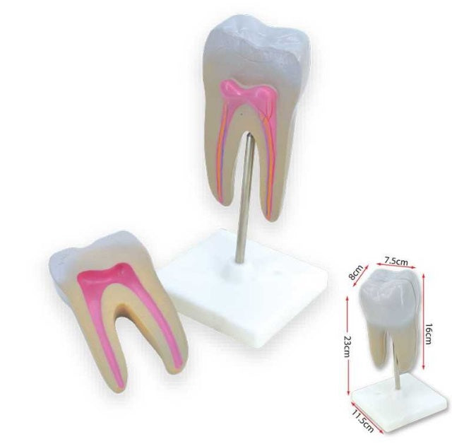 Wisdom Tooth Model - SC0167 MZ