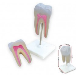 Wisdom Tooth Model - SC0167 MZ 